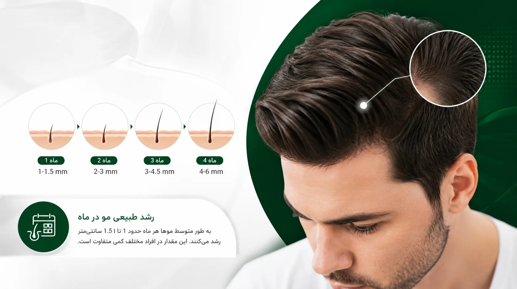 رشد طبیعی مو در ماه چقدر است؟